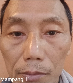 Avatar of Mampang Prapatan